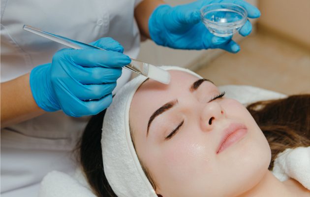 Peeling superficiel