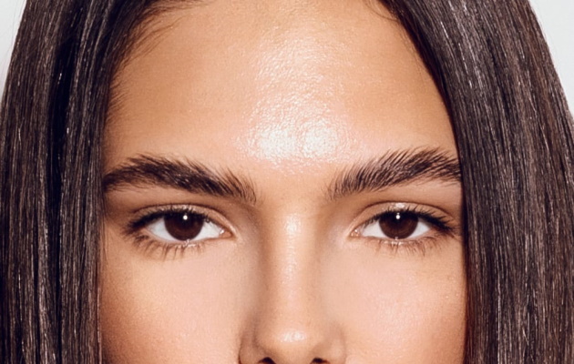 Brow lift